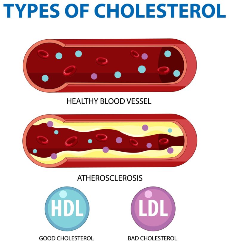 Jak obniżyć cholesterol dietą? Skuteczne strategie i produkty, które pomogą w zdrowym żywieniu